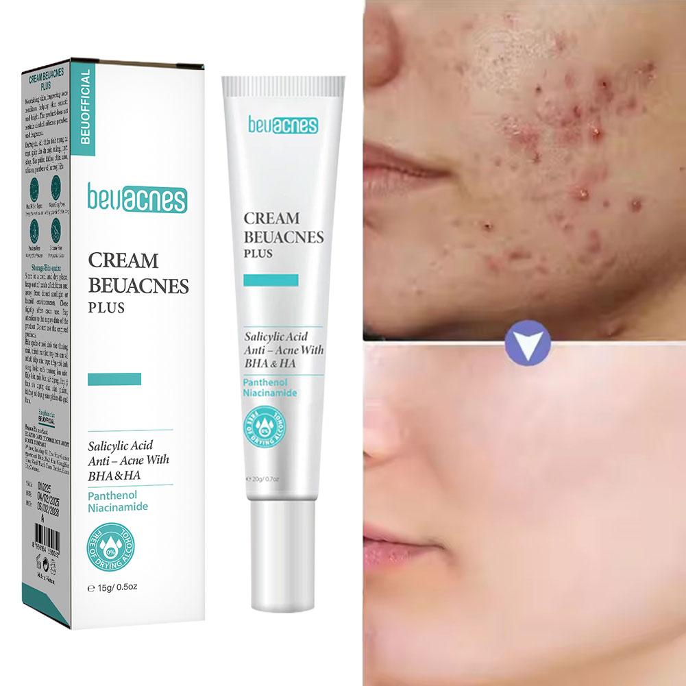 New 20g Niacinamide Acne Gel A - Skincare Niacinamide recension och pris