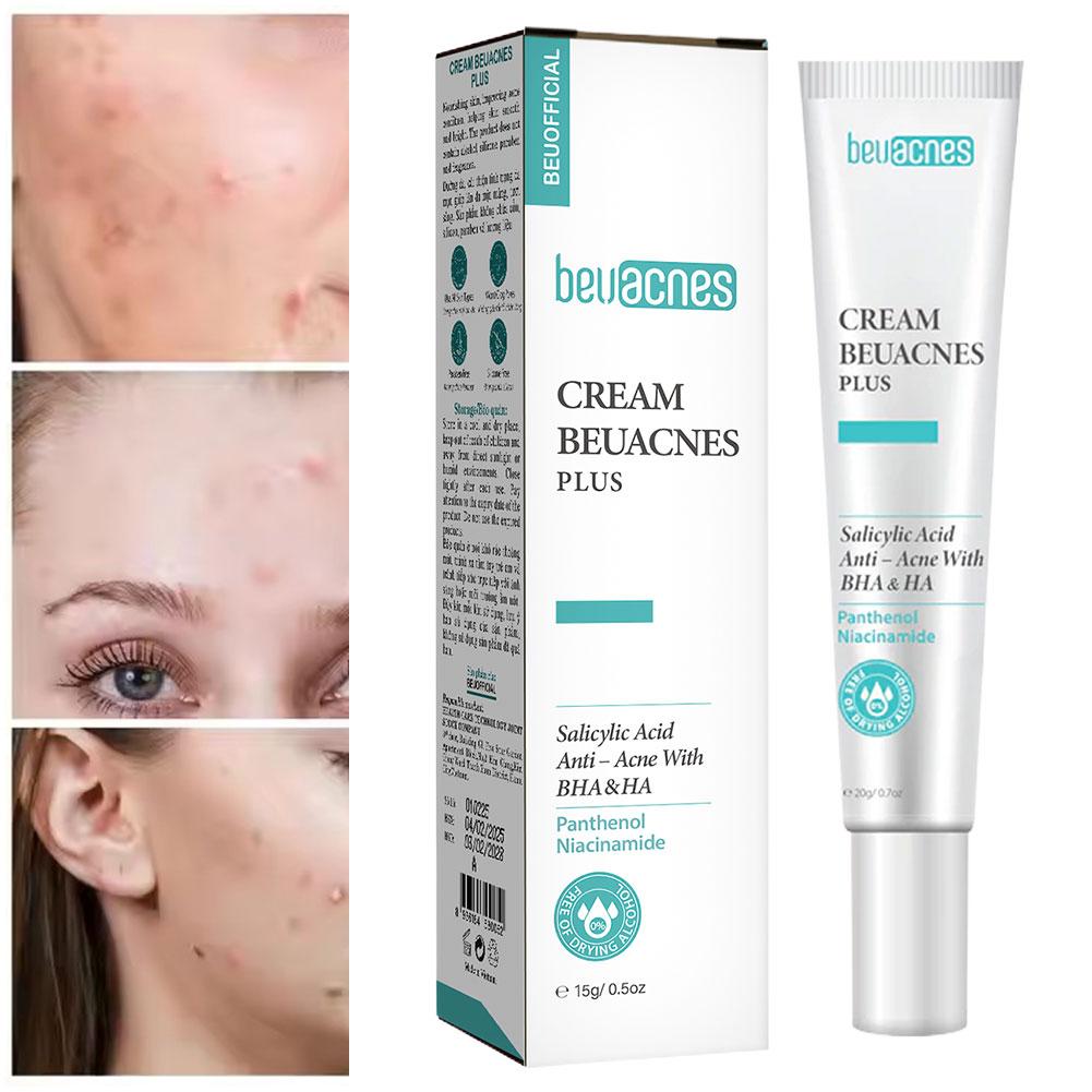 New 20g Niacinamide Acne Gel A - Skincare Niacinamide recension och pris