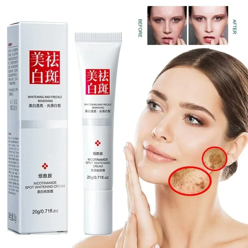 Fades Freckle Dark Spots Face  - Skincare Niacinamide recension och pris