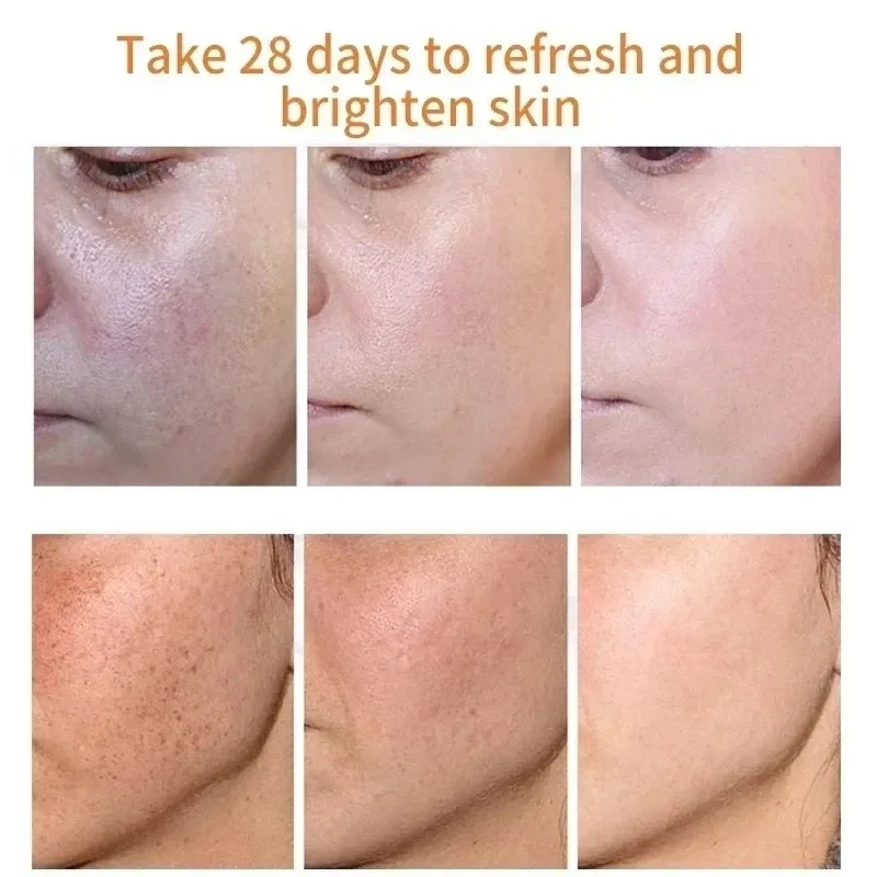 Fades Freckle Dark Spots Face  - Skincare Niacinamide recension och pris