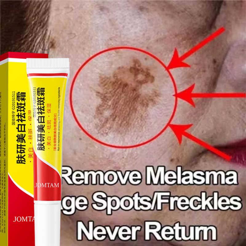 Whitening Freckle Cream Face B - Skincare Niacinamide recension och pris