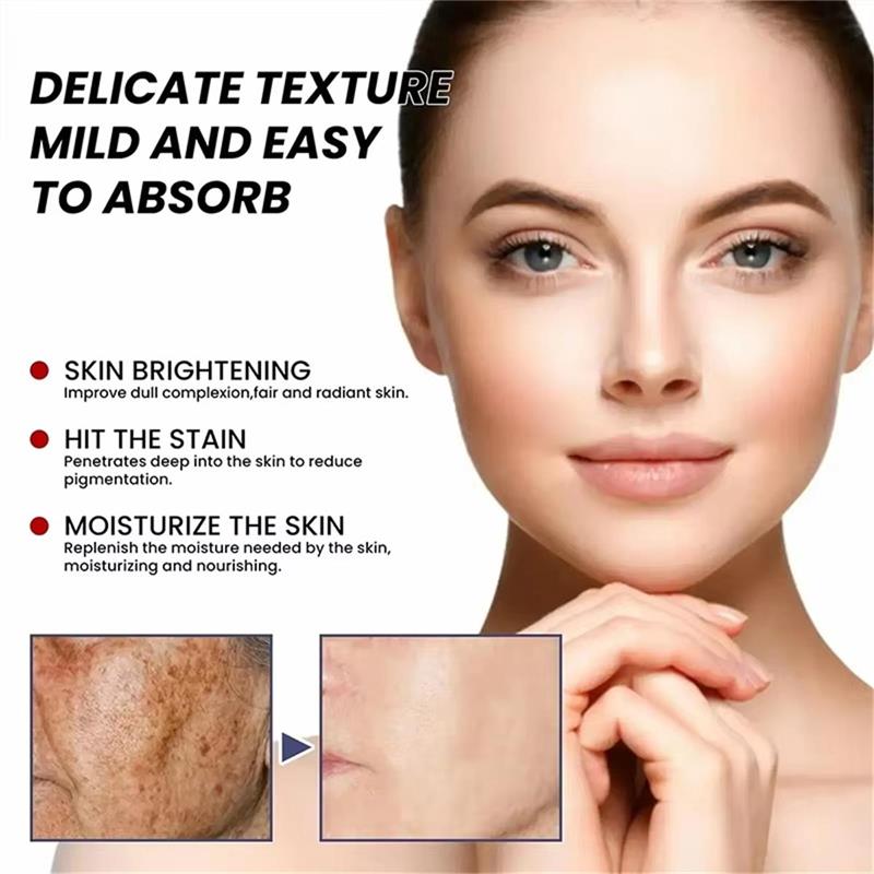 Whitening Freckle Cream Face B - Skincare Niacinamide recension och pris